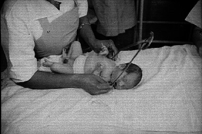 Recien nacido es revisado por una enfermera