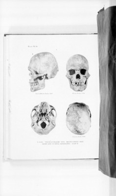 Cráneos humanos, ilustración
